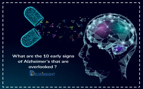 Alzheimers dream interpretation： Is it a warning sign？